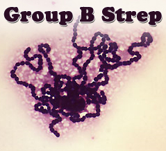 Positive For Group B Strep 105